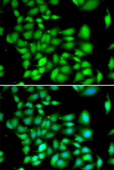 TREX1 Antibody - Immunofluorescence analysis of A549 cells.