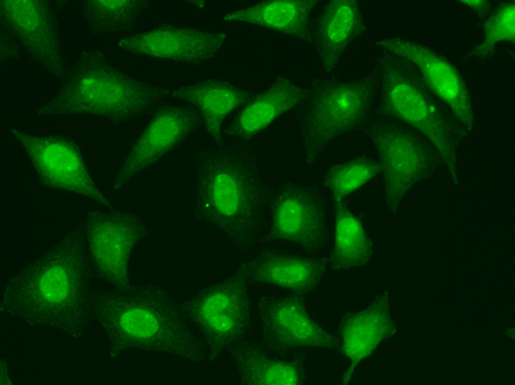 TREX1 Antibody - Immunofluorescence analysis of HeLa cells.