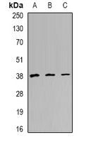 TREX1 Antibody - Western blot analysis of TREX1 expression in HeLa (A); Raji (B); mouse heart (C) whole cell lysates.