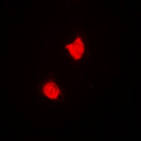 TREX1 Antibody - Immunofluorescent analysis of TREX1 staining in A549 cells. Formalin-fixed cells were permeabilized with 0.1% Triton X-100 in TBS for 5-10 minutes and blocked with 3% BSA-PBS for 30 minutes at room temperature. Cells were probed with the primary antibody in 3% BSA-PBS and incubated overnight at 4 deg C in a humidified chamber. Cells were washed with PBST and incubated with a DyLight 594-conjugated secondary antibody (red) in PBS at room temperature in the dark.