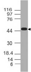TREX1 Antibody - Fig-1: Western blot analysis of TREX1. Anti TREX1 was used at 4 µg/ml in Daudi lysate.