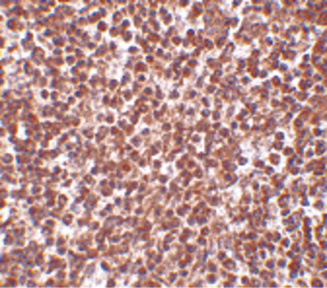 TREX1 Antibody - Immunohistochemistry of TREX1 in human spleen tissue with TREX1 antibody at 2.5 ug/ml.