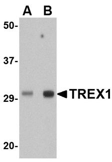 TREX1 Antibody - Western blot of TREX1 in human spleen tissue lysate with TREX1 antibody at (A) 0.5 ug/ml and (B) 1 ug/ml
