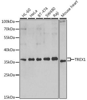 TREX1 Antibody - Western blot analysis of extracts of various cell lines using TREX1 Polyclonal Antibody at dilution of 1:1000.