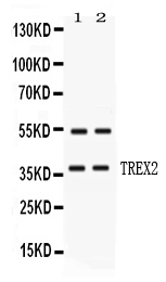 TREX2 Antibody - Western blot analysis of TREX2 expression in HELA whole cell lysates and MCF-7 whole cell lysates. TREX2 at 37KD was detected using rabbit anti-TREX2 Antigen Affinity purified polyclonal antibody at 0.5 ug/ml. The blot was developed using chemiluminescence (ECL) method.