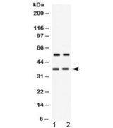 TREX2 Antibody - Western blot testing of human 1) HeLa and 2) MCF7 cell lysate with TREX2 antibody at 0.5ug/ml. Predicted molecular weight ~31/26 kDa (isoforms 1/2), observed here at ~37 kDa.