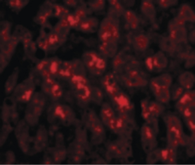 TREX2 Antibody - Immunofluorescence of TREX2 in Human Liver cells with TREX2 antibody at 20 ug/ml.
