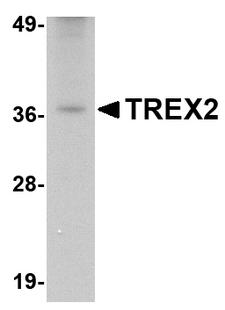 TREX2 Antibody - Western blot of TREX2 in rat liver tissue lysate with TREX2 antibody at 2.5 ug/ml