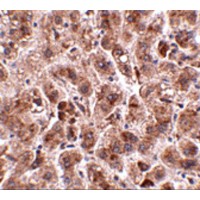TREX2 Antibody - Immunohistochemistry of TREX2 in human liver tissue with TREX2 antibody at 2.5 µg/mL.