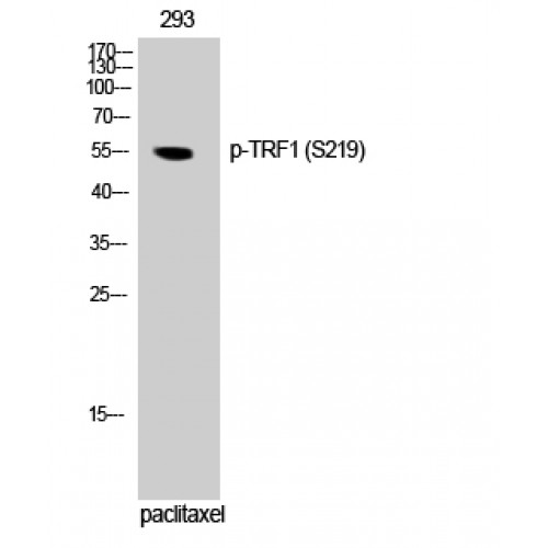 TRF1 / TERF1 Antibody - Western blot of Phospho-TRF1 (S219) antibody
