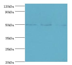 TRF1 / TERF1 Antibody - Western blot. All lanes: TERF1 antibody at 2 ug/ml. Lane 1: k562 whole cell lysate. Lane 2: 293T whole cell lysate. Lane 3: Jurkat whole cell lysate. Secondary antibody: Goat polyclonal to rabbit at 1:10000 dilution. Predicted band size: 50 kDa. Observed band size: 50 kDa.