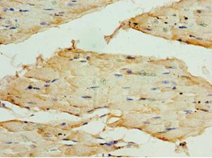 TRF1 / TERF1 Antibody - Immunohistochemistry of paraffin-embedded human skeletal muscle tissue using antibody at 1:100 dilution.