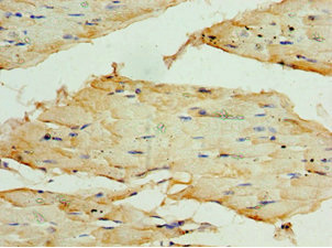 TRF1 / TERF1 Antibody - Immunohistochemistry of paraffin-embedded human skeletal muscle tissue using TERF1 Antibody at dilution of 1:100