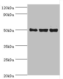 TRF1 / TERF1 Antibody - Western blot All lanes: TERF1 antibody at 2µg/ml Lane 1: k562 whole cell lysate Lane 2: 293T whole cell lysate Lane 3: Jurkat whole cell lysate Secondary Goat polyclonal to rabbit IgG at 1/10000 dilution Predicted band size: 51, 49 kDa Observed band size: 51 kDa