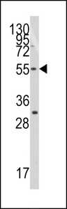 TRF1 / TERF1 Antibody - Western blot of anti-TERF1 antibody in Jurkat cell line lysates (35 ug/lane). TERF1(arrow) was detected using the purified antibody.