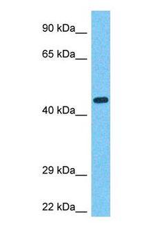 TRF1 / TERF1 Antibody - Western blot of TERF1 Antibody with human Fetal Liver lysate.  This image was taken for the unconjugated form of this product. Other forms have not been tested.
