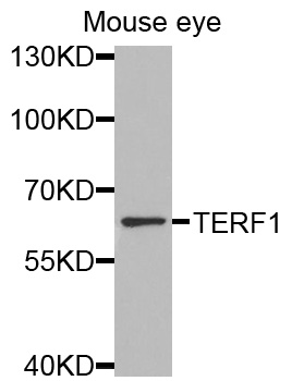 TRF1 / TERF1 Antibody - Western blot analysis of extracts of mouse eye, using TERF1 antibody at 1:1000 dilution. The secondary antibody used was an HRP Goat Anti-Rabbit IgG (H+L) at 1:10000 dilution. Lysates were loaded 25ug per lane and 3% nonfat dry milk in TBST was used for blocking.