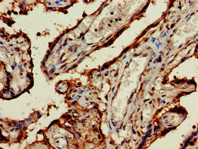 TRF1 / TERF1 Antibody - Immunohistochemistry of paraffin-embedded human placenta tissue at dilution of 1:100