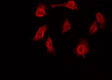 TRF1 / TERF1 Antibody - Staining 293 cells by IF/ICC. The samples were fixed with PFA and permeabilized in 0.1% Triton X-100, then blocked in 10% serum for 45 min at 25°C. The primary antibody was diluted at 1:200 and incubated with the sample for 1 hour at 37°C. An Alexa Fluor 594 conjugated goat anti-rabbit IgG (H+L) Ab, diluted at 1/600, was used as the secondary antibody.