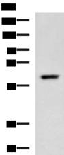 TRF1 / TERF1 Antibody - Western blot analysis of A549 cell lysate  using TERF1 Polyclonal Antibody at dilution of 1:400
