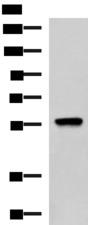 TRF1 / TERF1 Antibody - Western blot analysis of A549 cell lysate  using TERF1 Polyclonal Antibody at dilution of 1:1000