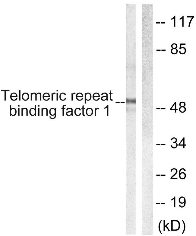TRF1 / TERF1 Antibody - Western blot analysis of extracts from 293 cells, treated with Paclitaxel (1uMl, 24hours), using Telomeric Repeat Binding Factor 1 (Ab-219) antibody.