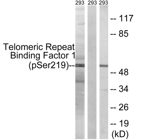 TRF1 / TERF1 Antibody - Western blot analysis of lysates from 293 cells treated with paclitaxel 1uM 24h, using Telomeric Repeat Binding Factor 1 (Phospho-Ser219) Antibody. The lane on the right is blocked with the phospho peptide.