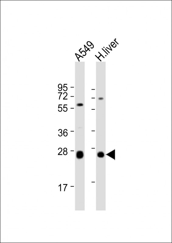 TRH Antibody - All lanes: Anti-TRH Antibody (C-Term) at 1:2000 dilution. Lane 1: A549 whole cell lysate. Lane 2: human liver lysate Lysates/proteins at 20 ug per lane. Secondary Goat Anti-Rabbit IgG, (H+L), Peroxidase conjugated at 1:10000 dilution. Predicted band size: 27 kDa. Blocking/Dilution buffer: 5% NFDM/TBST.