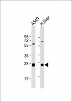 TRH Antibody - All lanes: Anti-TRH Antibody (C-Term) at 1:2000 dilution. Lane 1: A549 whole cell lysate. Lane 2: human liver lysate Lysates/proteins at 20 ug per lane. Secondary Goat Anti-Rabbit IgG, (H+L), Peroxidase conjugated at 1:10000 dilution. Predicted band size: 27 kDa. Blocking/Dilution buffer: 5% NFDM/TBST.