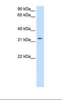 TRH Antibody - Transfected 293T cell lysate. Antibody concentration: 0.5 ug/ml. Gel concentration: 12%.  This image was taken for the unconjugated form of this product. Other forms have not been tested.