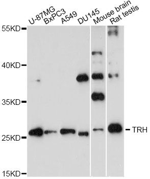 TRH Antibody - Western blot analysis of extracts of various cell lines, using TRH antibody at 1:3000 dilution. The secondary antibody used was an HRP Goat Anti-Rabbit IgG (H+L) at 1:10000 dilution. Lysates were loaded 25ug per lane and 3% nonfat dry milk in TBST was used for blocking. An ECL Kit was used for detection and the exposure time was 90s.