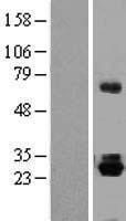 TRH Protein - Western validation with an anti-DDK antibody * L: Control HEK293 lysate R: Over-expression lysate
