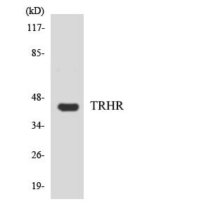 TRH Receptor / TRHR Antibody - Western blot analysis of the lysates from HepG2 cells using TRHR antibody.