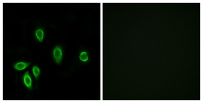 TRH Receptor / TRHR Antibody - Immunofluorescence of A549 cells, using TRHR Antibody. The picture on the right is treated with the synthesized peptide.