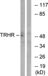 TRH Receptor / TRHR Antibody - Western blot of extracts from COS7 cells, using TRHR Antibody. The lane on the right is treated with the synthesized peptide.