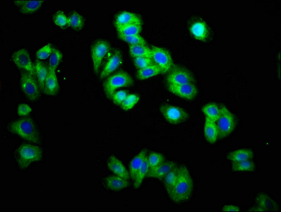 TRH Receptor / TRHR Antibody - Immunofluorescence staining of HepG2 cells at a dilution of 1:166, counter-stained with DAPI. The cells were fixed in 4% formaldehyde, permeabilized using 0.2% Triton X-100 and blocked in 10% normal Goat Serum. The cells were then incubated with the antibody overnight at 4 °C.The secondary antibody was Alexa Fluor 488-congugated AffiniPure Goat Anti-Rabbit IgG (H+L) .