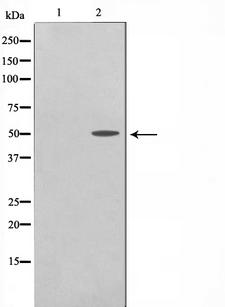 TRH Receptor / TRHR Antibody - Western blot analysis on COS7 cell lysates using TRHR antibody. The lane on the left is treated with the antigen-specific peptide.