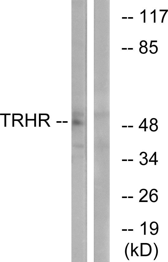 TRH Receptor / TRHR Antibody - Western blot analysis of extracts from COS-7 cells, using TRHR antibody.