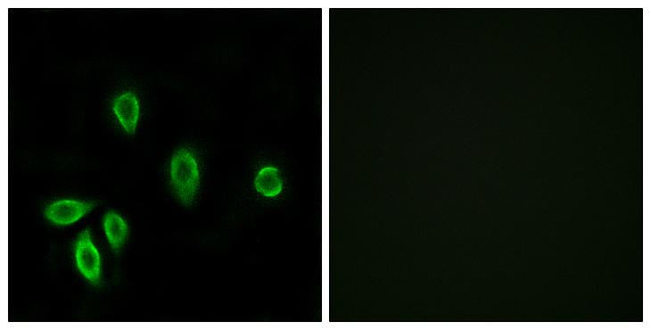 TRH Receptor / TRHR Antibody - Peptide - + Immunofluorescence analysis of A549 cells, using TRHR antibody.