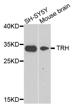 TRH / Thyrotropin Releasing Hormone Antibody - Western blot analysis of extract of various cells.