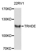 TRHDE Antibody - Western blot analysis of extracts of 22Rv1 cells, using TRHDE antibody at 1:1000 dilution. The secondary antibody used was an HRP Goat Anti-Rabbit IgG (H+L) at 1:10000 dilution. Lysates were loaded 25ug per lane and 3% nonfat dry milk in TBST was used for blocking. An ECL Kit was used for detection and the exposure time was 90s.