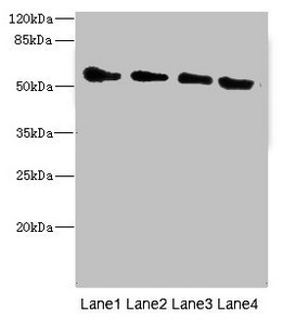 TRHDE Antibody - Western blot All Lanes: TRHDE antibody at 1.77ug/ml Lane 1: Rat heart tissue Lane 2: Mouse kidney tissue Lane 3: 293T whole cell lysate Lane 4: HepG-2 whole cell lysate Secondary Goat polyclonal to rabbit IgG at 1/10000 dilution Predicted band size: 117 kDa Observed band size: 117 kDa