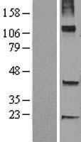 TRHDE Protein - Western validation with an anti-DDK antibody * L: Control HEK293 lysate R: Over-expression lysate
