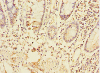 TRIAP1 Antibody - Immunohistochemistry of paraffin-embedded human small intestine at dilution 1:100