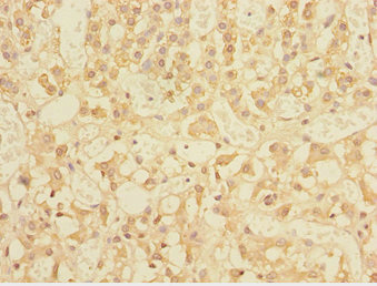 TRIAP1 Antibody - Immunohistochemistry of paraffin-embedded human adrenal gland tissue at dilution 1:100
