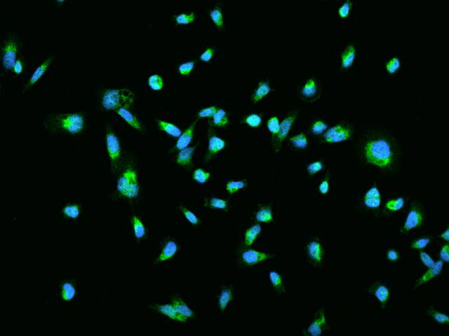 TRIAP1 Antibody - Immunofluorescence staining of TRIAP1 in PC3 cells. Cells were fixed with 4% PFA, permeabilzed with 0.1% Triton X-100 in PBS, blocked with 10% serum, and incubated with rabbit anti-Human TRIAP1 polyclonal antibody (dilution ratio 1:200) at 4°C overnight. Then cells were stained with the Alexa Fluor 488-conjugated Goat Anti-rabbit IgG secondary antibody (green) and counterstained with DAPI (blue). Positive staining was localized to Nucleus and Cytoplasm.