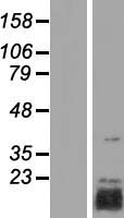 TRIAP1 Protein - Western validation with an anti-DDK antibody * L: Control HEK293 lysate R: Over-expression lysate