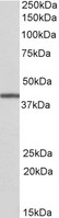 TRIB1 Antibody - TRIB1 antibody EB9630 (0.3 ug/ml) staining of Human Bone Marrow lysate (35 ug protein in RIPA buffer). Primary incubation was 1 hour. Detected by chemiluminescence.