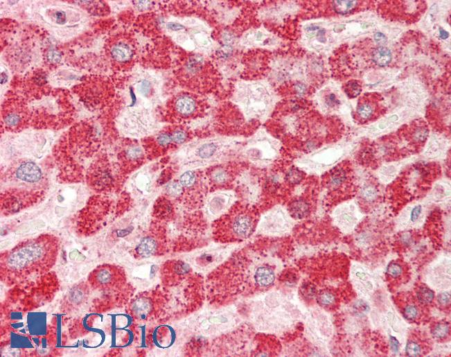 TRIB1 Antibody - Human Liver: Formalin-Fixed, Paraffin-Embedded (FFPE).  This image was taken for the unconjugated form of this product. Other forms have not been tested.