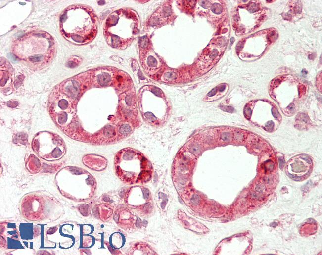 TRIB1 Antibody - Human Kidney: Formalin-Fixed, Paraffin-Embedded (FFPE).  This image was taken for the unconjugated form of this product. Other forms have not been tested.
